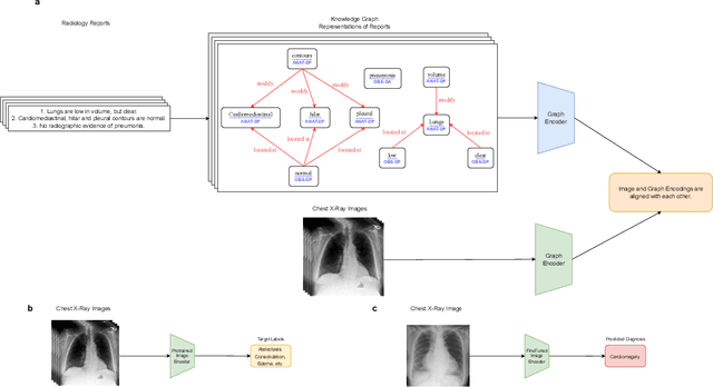 Figure 1 for Learning Generalized Medical Image Representations through Image-Graph Contrastive Pretraining