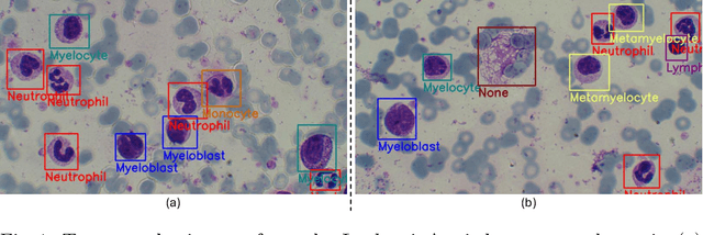 Figure 4 for A Large-scale Multi Domain Leukemia Dataset for the White Blood Cells Detection with Morphological Attributes for Explainability