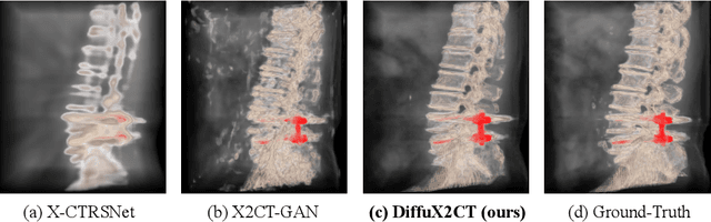 Figure 1 for DiffuX2CT: Diffusion Learning to Reconstruct CT Images from Biplanar X-Rays