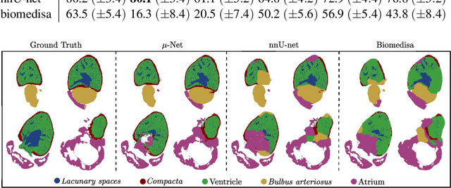 Figure 3 for μ-Net: A Deep Learning-Based Architecture for μ-CT Segmentation