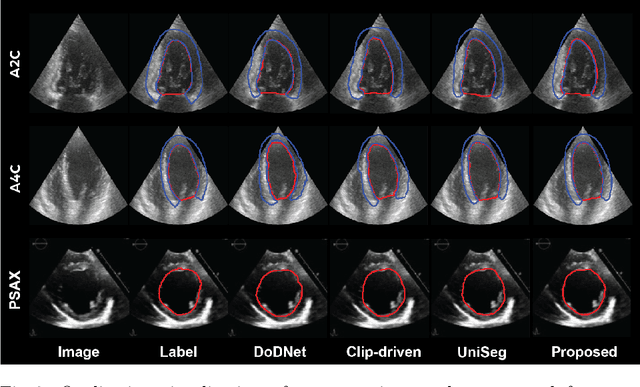 Figure 4 for Prompt-driven Universal Model for View-Agnostic Echocardiography Analysis