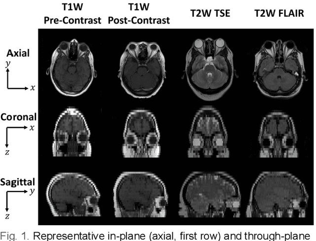 Figure 1 for Super-Resolution Multi-Contrast Unbiased Eye Atlases With Deep Probabilistic Refinement