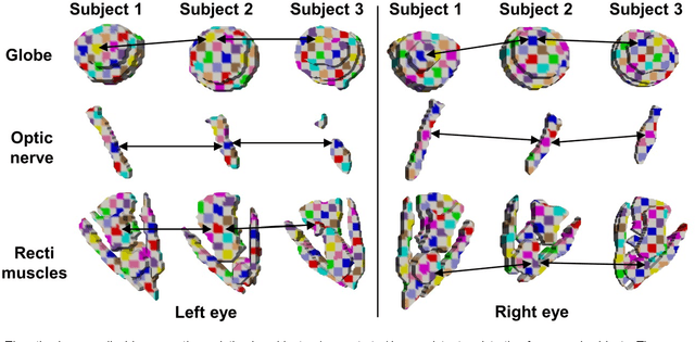 Figure 4 for Super-Resolution Multi-Contrast Unbiased Eye Atlases With Deep Probabilistic Refinement