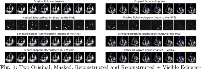 Figure 1 for Echocardiogram Foundation Model -- Application 1: Estimating Ejection Fraction