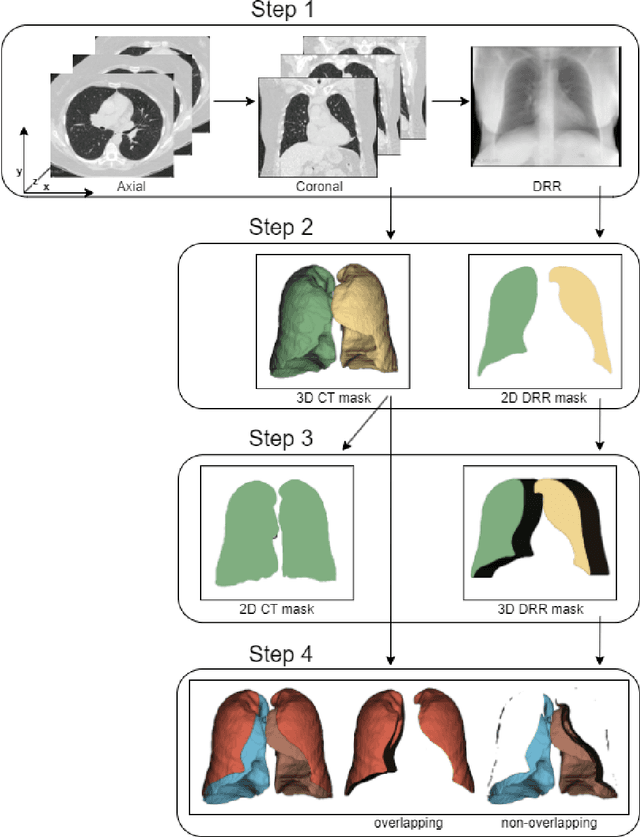 Figure 3 for Underestimation of lung regions on chest X-ray segmentation masks assessed by comparison with total lung volume evaluated on computed tomography