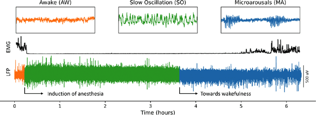 Figure 3 for Hopfield-Enhanced Deep Neural Networks for Artifact-Resilient Brain State Decoding