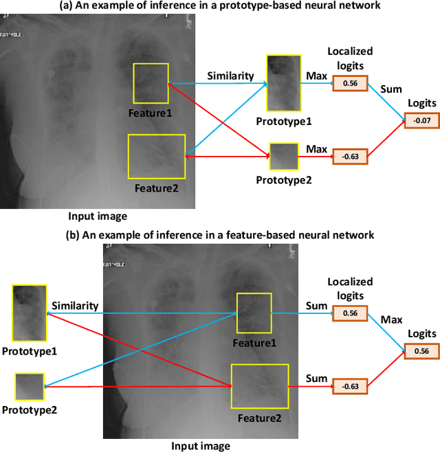 Figure 1 for FeaInfNet: Diagnosis in Medical Image with Feature-Driven Inference and Visual Explanations