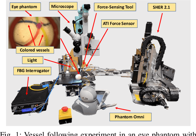 Figure 1 for Cooperative vs. Teleoperation Control of the Steady Hand Eye Robot with Adaptive Sclera Force Control: A Comparative Study