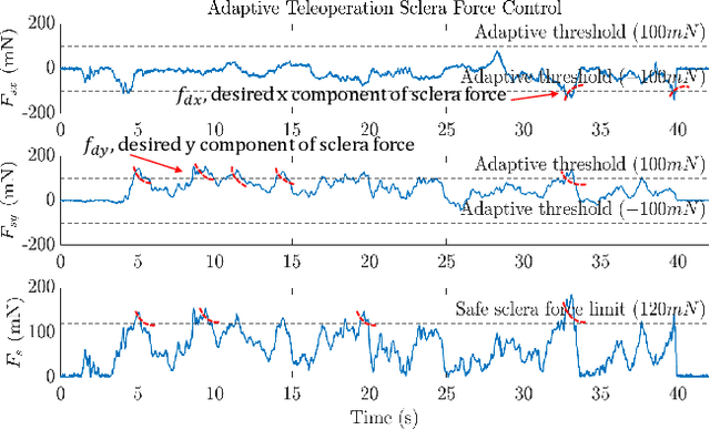 Figure 4 for Cooperative vs. Teleoperation Control of the Steady Hand Eye Robot with Adaptive Sclera Force Control: A Comparative Study