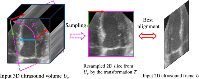 Figure 1 for Epicardium Prompt-guided Real-time Cardiac Ultrasound Frame-to-volume Registration