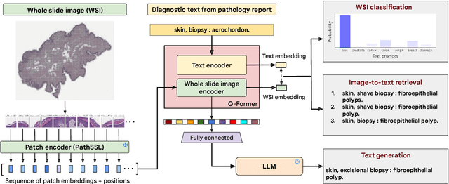 Figure 1 for PathAlign: A vision-language model for whole slide images in histopathology