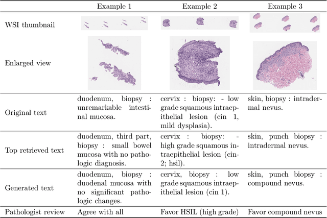 Figure 4 for PathAlign: A vision-language model for whole slide images in histopathology