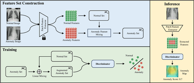 Figure 1 for Weakly Supervised Anomaly Detection for Chest X-Ray Image