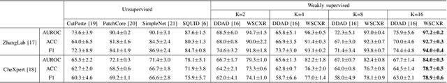 Figure 3 for Weakly Supervised Anomaly Detection for Chest X-Ray Image