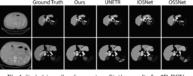 Figure 4 for SwIPE: Efficient and Robust Medical Image Segmentation with Implicit Patch Embeddings