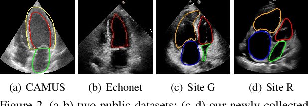 Figure 3 for GraphEcho: Graph-Driven Unsupervised Domain Adaptation for Echocardiogram Video Segmentation