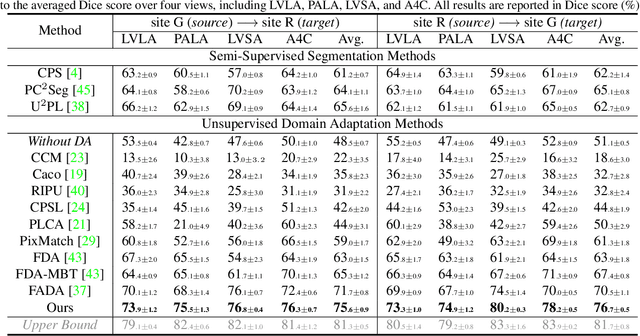 Figure 4 for GraphEcho: Graph-Driven Unsupervised Domain Adaptation for Echocardiogram Video Segmentation