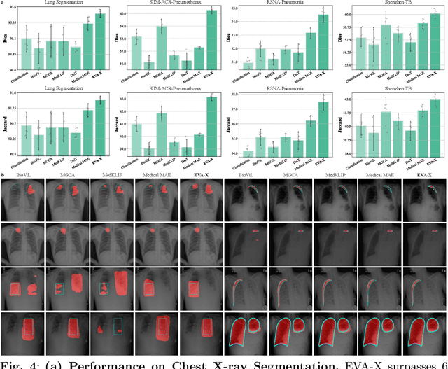 Figure 4 for EVA-X: A Foundation Model for General Chest X-ray Analysis with Self-supervised Learning