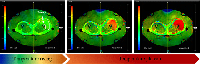 Figure 1 for Fourier PD and PDUNet: Complex-valued networks to speed-up MR Thermometry during Hypterthermia