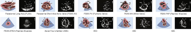 Figure 4 for Structure-aware World Model for Probe Guidance via Large-scale Self-supervised Pre-train