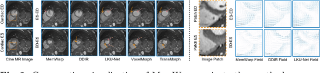 Figure 3 for MemWarp: Discontinuity-Preserving Cardiac Registration with Memorized Anatomical Filters