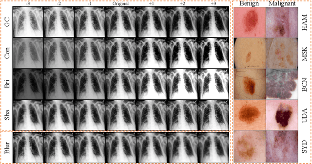 Figure 1 for Robustness Stress Testing in Medical Image Classification