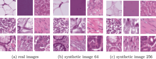 Figure 3 for Image Distillation for Safe Data Sharing in Histopathology