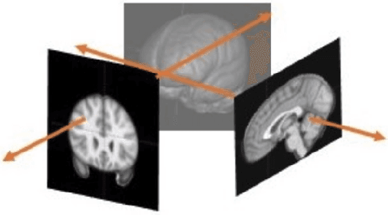 Figure 4 for Neural Radiance Fields in Medical Imaging: Challenges and Next Steps