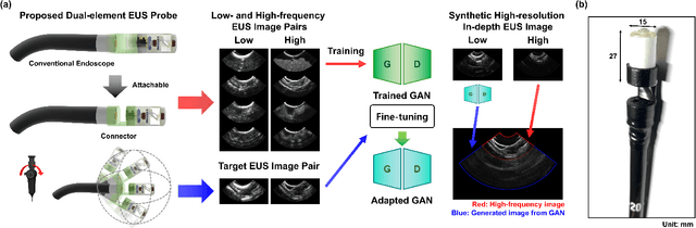 Figure 1 for Deep Learning-based Synthetic High-Resolution In-Depth Imaging Using an Attachable Dual-element Endoscopic Ultrasound Probe