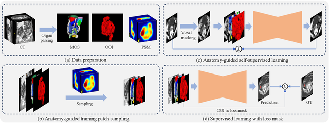 Figure 2 for AG-CRC: Anatomy-Guided Colorectal Cancer Segmentation in CT with Imperfect Anatomical Knowledge