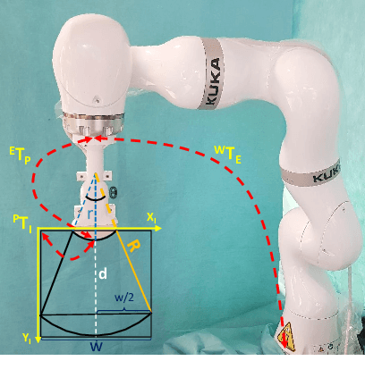 Figure 3 for Implicit Neural Representations for Breathing-compensated Volume Reconstruction in Robotic Ultrasound Aorta Screening