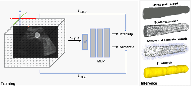 Figure 4 for Implicit Neural Representations for Breathing-compensated Volume Reconstruction in Robotic Ultrasound Aorta Screening