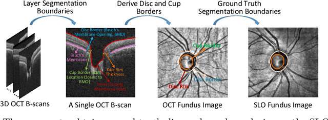 Figure 2 for FairSeg: A Large-scale Medical Image Segmentation Dataset for Fairness Learning with Fair Error-Bound Scaling