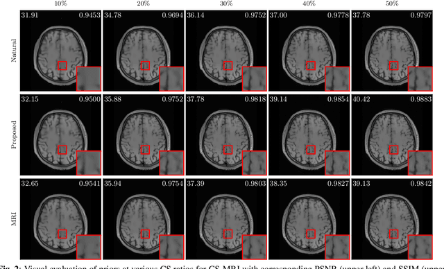 Figure 3 for Overcoming Distribution Shifts in Plug-and-Play Methods with Test-Time Training