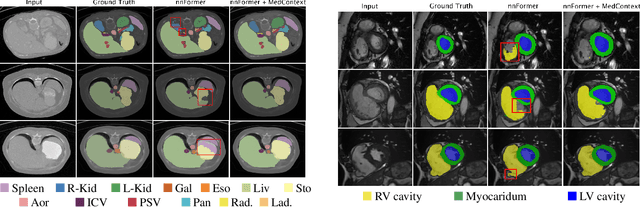 Figure 3 for MedContext: Learning Contextual Cues for Efficient Volumetric Medical Segmentation