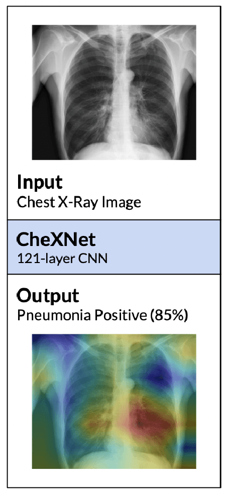 Figure 1 for Semantic match: Debugging feature attribution methods in XAI for healthcare