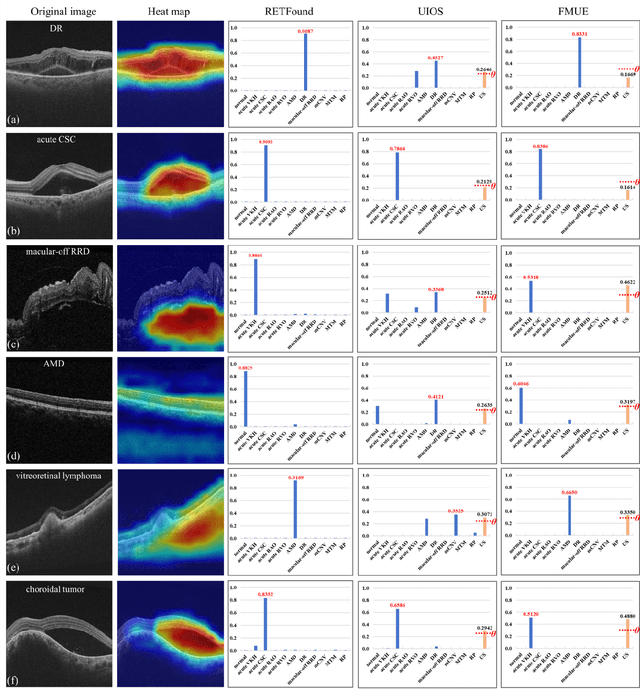 Figure 4 for Enhancing Diagnostic Reliability of Foundation Model with Uncertainty Estimation in OCT Images