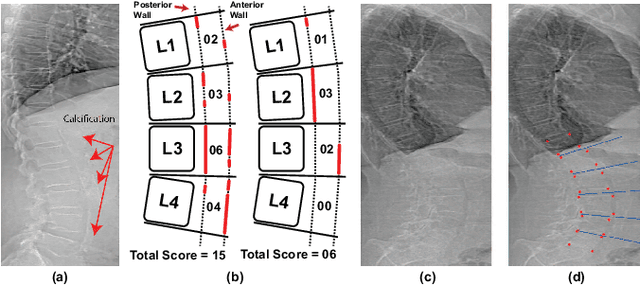 Figure 1 for AACLiteNet: A Lightweight Model for Detection of Fine-Grained Abdominal Aortic Calcification