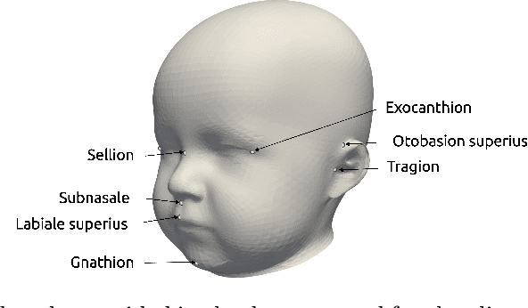 Figure 1 for Impact of Data Synthesis Strategies for the Classification of Craniosynostosis