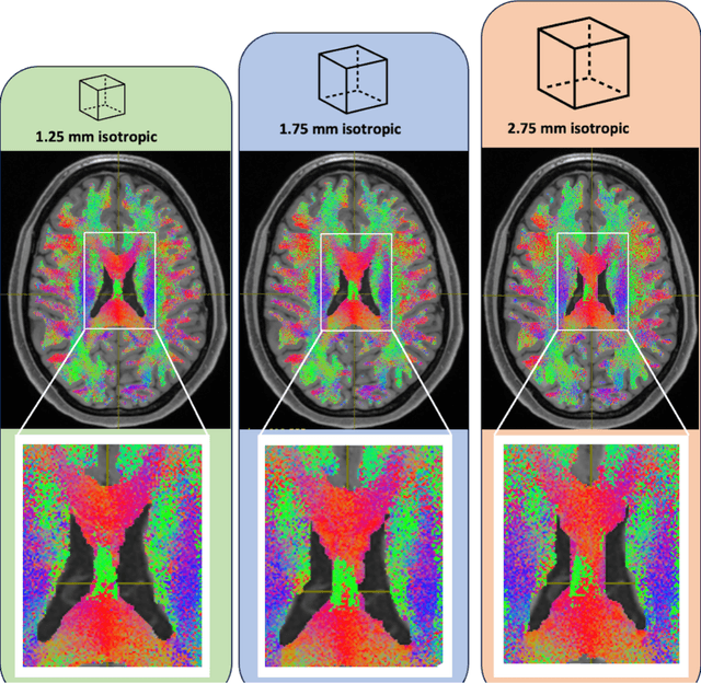 Figure 1 for Harmonized connectome resampling for variance in voxel sizes