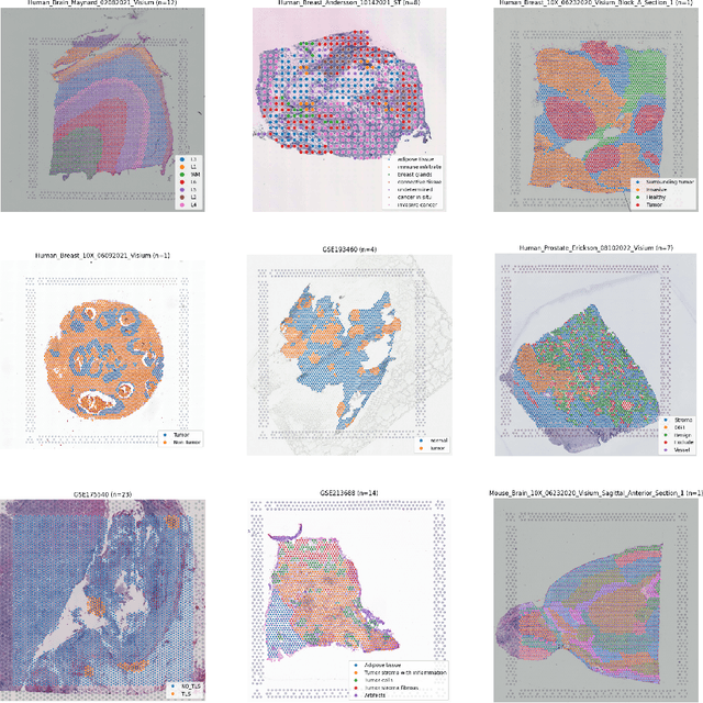 Figure 4 for STimage-1K4M: A histopathology image-gene expression dataset for spatial transcriptomics