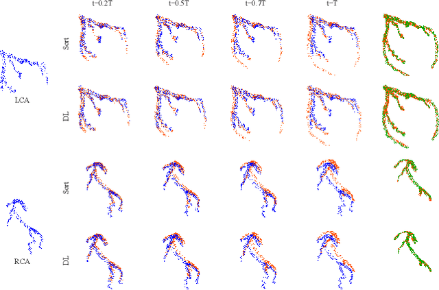 Figure 3 for 4D-CAT: Synthesis of 4D Coronary Artery Trees from Systole and Diastole