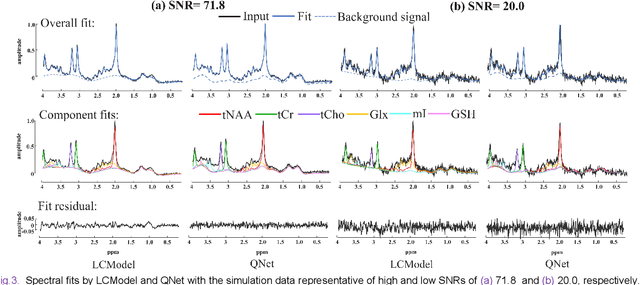 Figure 4 for Magnetic Resonance Spectroscopy Quantification Aided by Deep Estimations of Imperfection Factors and Overall Macromolecular Signal