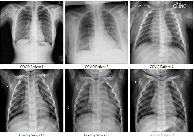 Figure 3 for CL3: A Collaborative Learning Framework for the Medical Data Ensuring Data Privacy in the Hyperconnected Environment