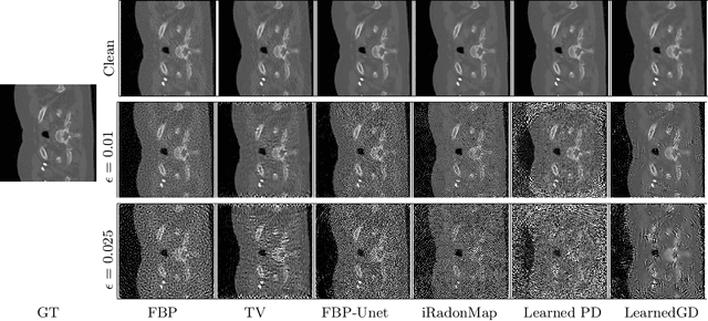 Figure 1 for Evaluating Adversarial Robustness of Low dose CT Recovery