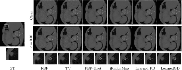 Figure 3 for Evaluating Adversarial Robustness of Low dose CT Recovery