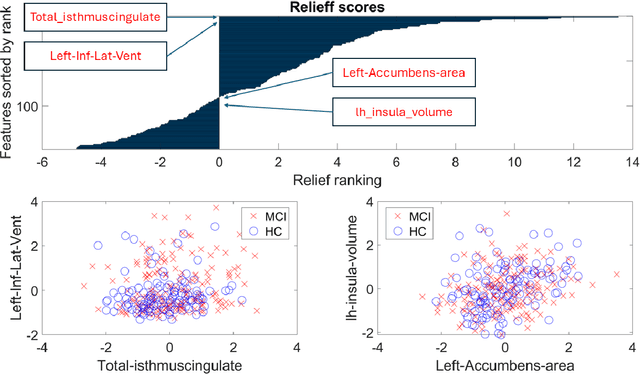 Figure 4 for Towards improving Alzheimer's intervention: a machine learning approach for biomarker detection through combining MEG and MRI pipelines