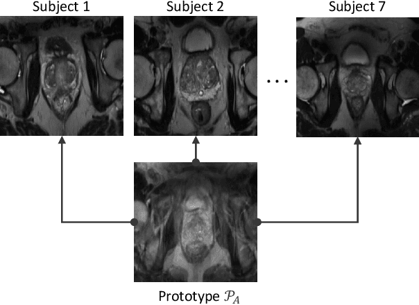 Figure 3 for Continual atlas-based segmentation of prostate MRI