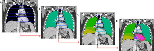 Figure 1 for SALT: Introducing a Framework for Hierarchical Segmentations in Medical Imaging using Softmax for Arbitrary Label Trees