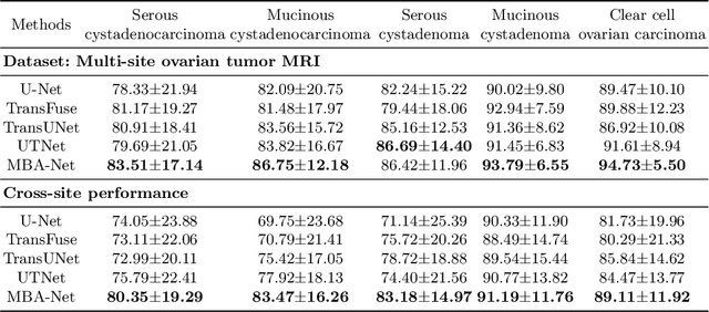 Figure 3 for MBA-Net: SAM-driven Bidirectional Aggregation Network for Ovarian Tumor Segmentation